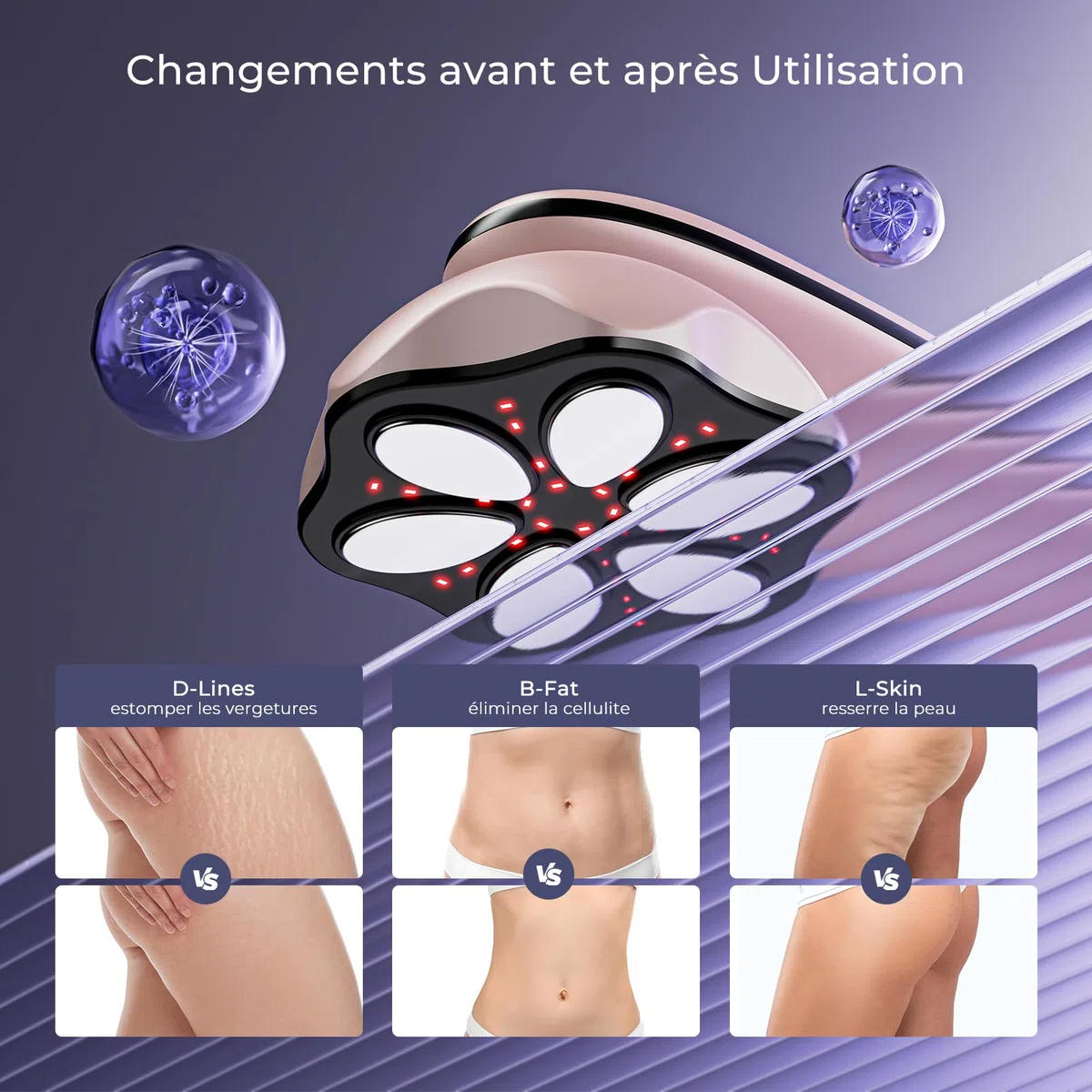 Masseur Anti Cellulite électriques Appareil Massage, 6 Têtes de Massage Multifonctionnel Portable, Unisexe, Lifte, Resserre et Masse la Peau (Rose Gold)