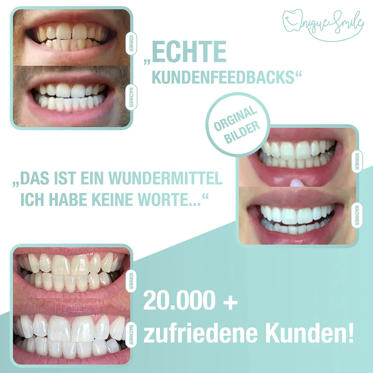Kit de blanchiment des dents UniqueSmile - Haute qualité, éclaircissement des dents blanches, essence sans risque