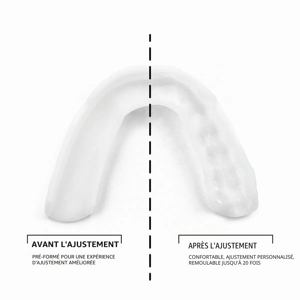SOVA Night Guard 3D Gouttière Dentaire Nocturne Bruxisme Protège-dents sur Mesure 1,6 mm