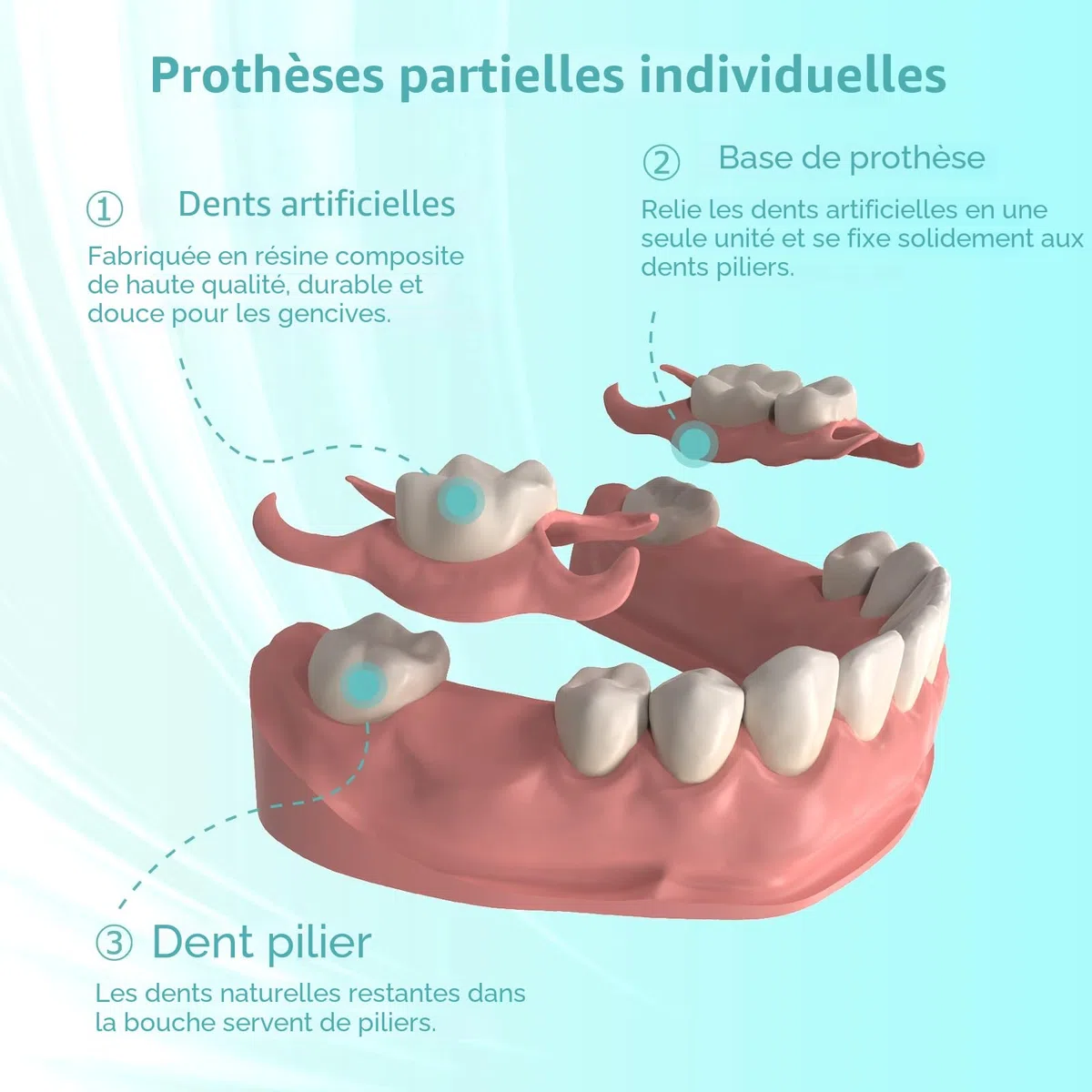 Prothèse Partielle Dentaire sur mesure - Dentier Provisoire, Prothese dentaire amovible et provisoire. Ajustement parfait et utilisation facile pour recréer votre sourire à domicile (3 dents)
