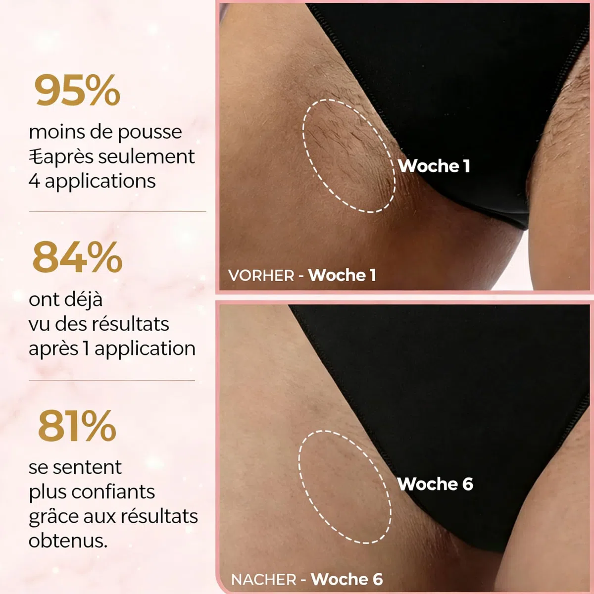 ARYA LUSH IPL Pulse épilateur lumière pulsée homme femme 5 niveaux 2 modes visage corps bikini aisselles noir