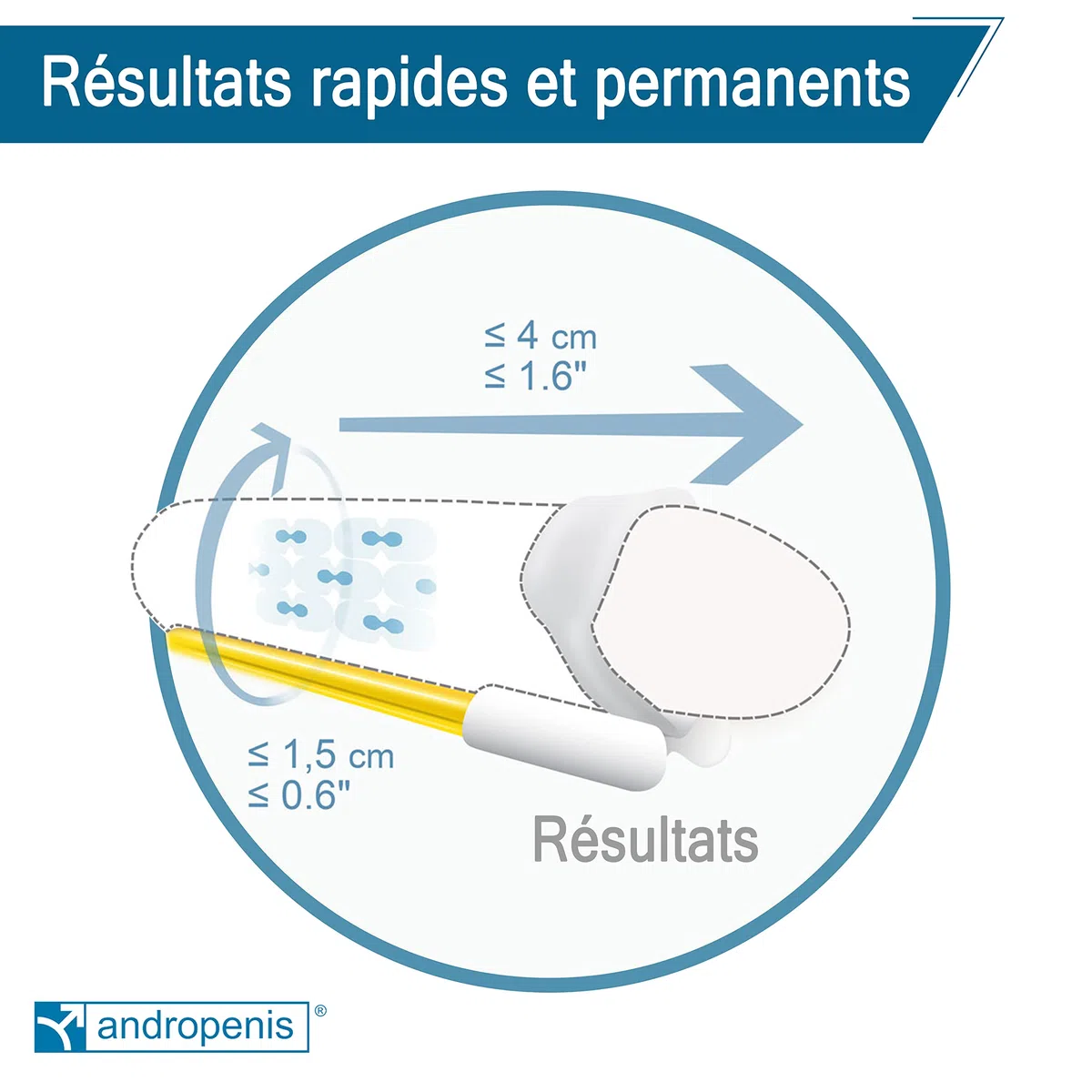 Andropenis Gold Extenseur Médical pour Allongement avec Comfort Kit