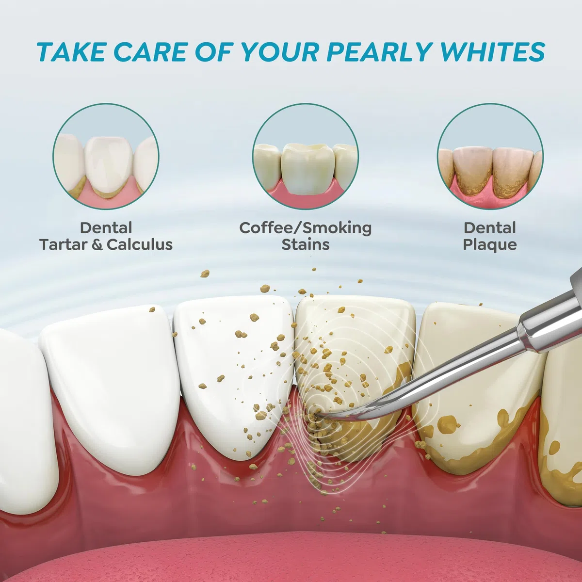 Kit Détartrage Dents Brosse à Dent Élimine Tartres Plaques Détartreur Oral Blanchiment Dentaires Hygiène Dentaire