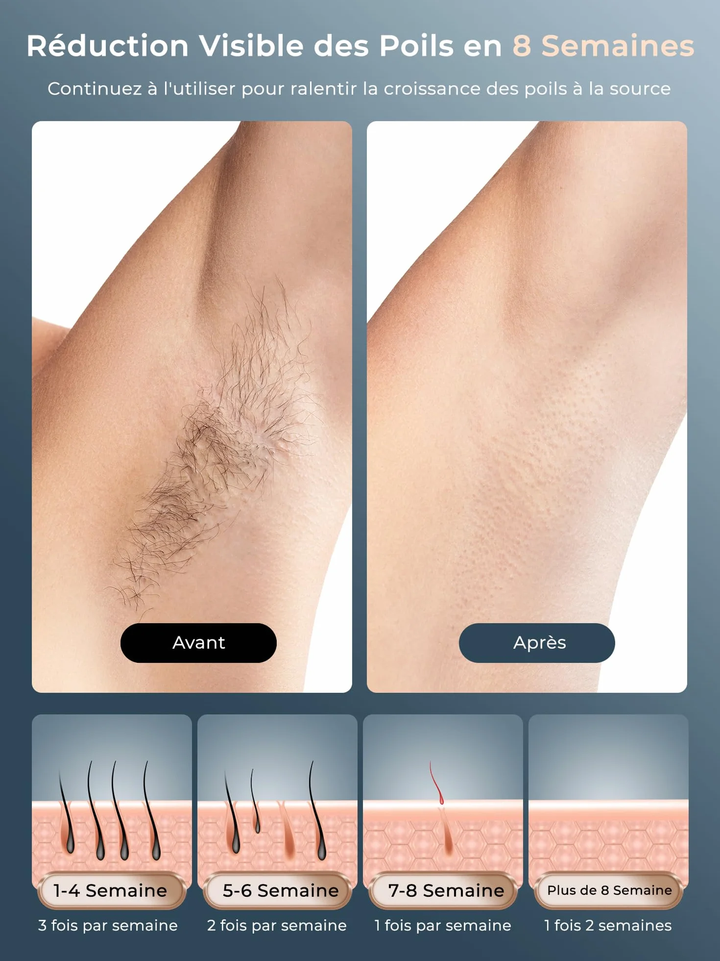 Épilateur Lumière Pulsée avec Refroidissement, 9 Niveaux d'Énergie, Visage, Aisselles, Bikini, Jambes, Corps, Blanc