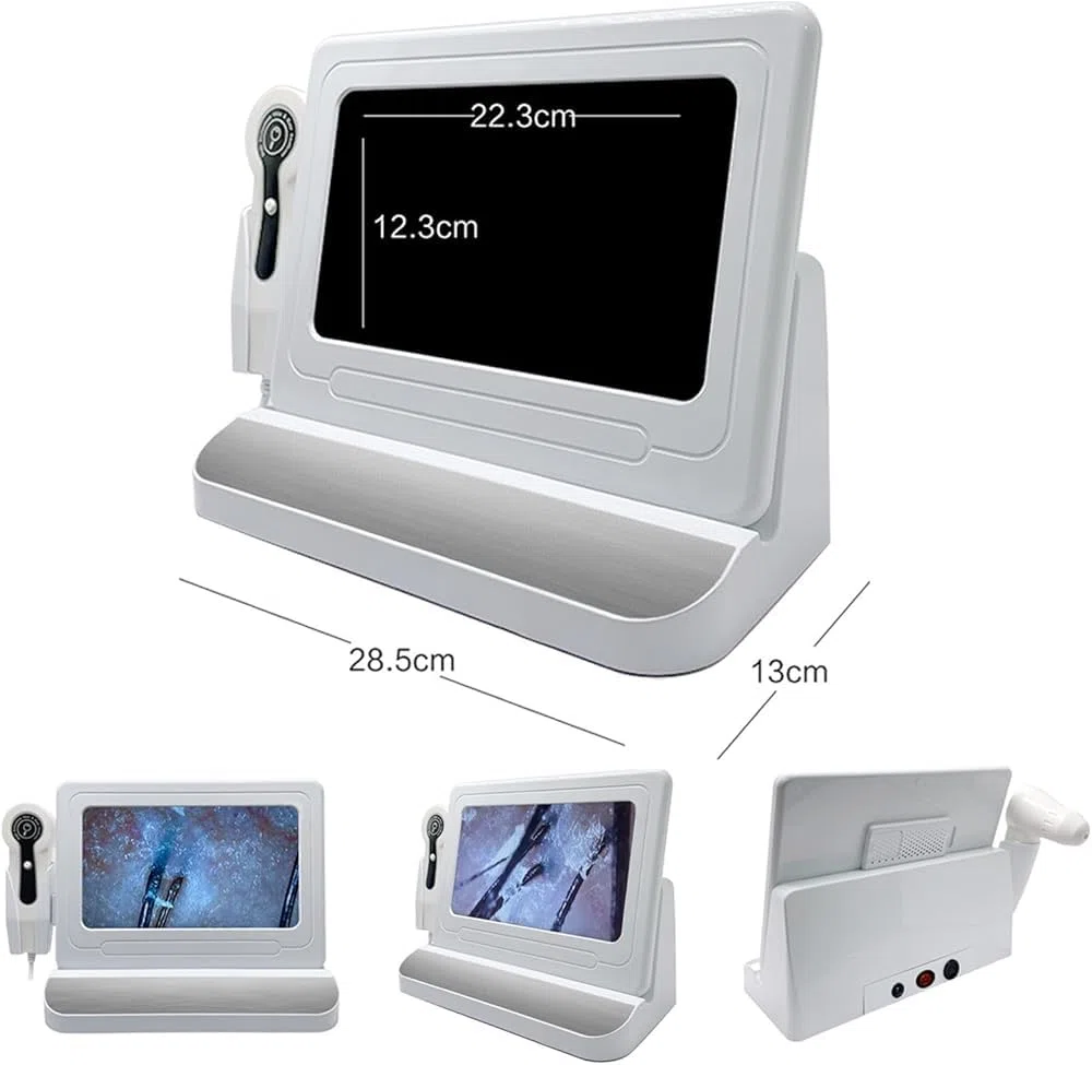 Analyseur de peau et cheveux HD LCD 11 pouces Détecteur follicules 50X/200X pour salon clinique