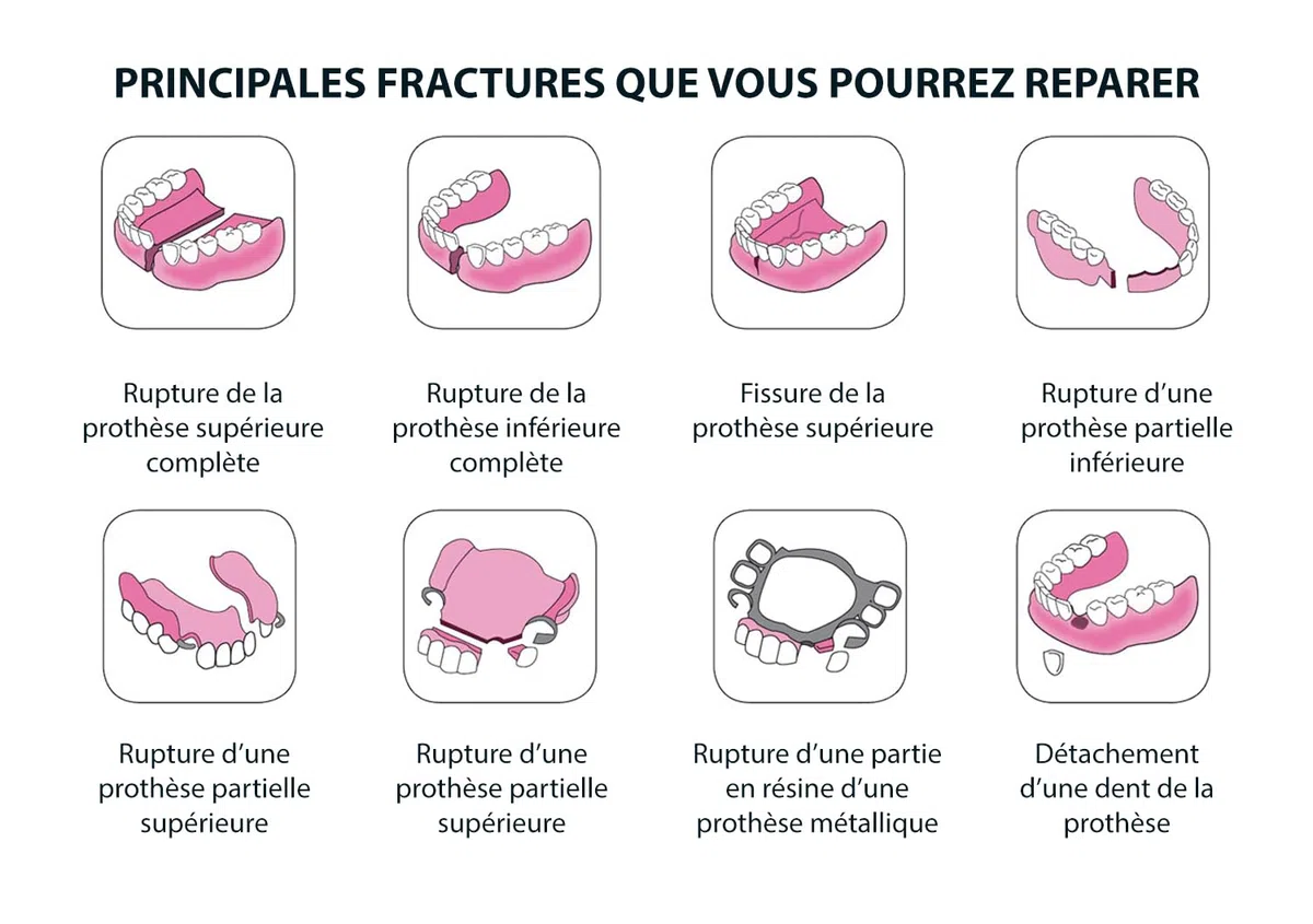 MEDIDENT SOS Réparation Dentier - Réparez votre dentier cassé - Nécessaire 3 utilisations