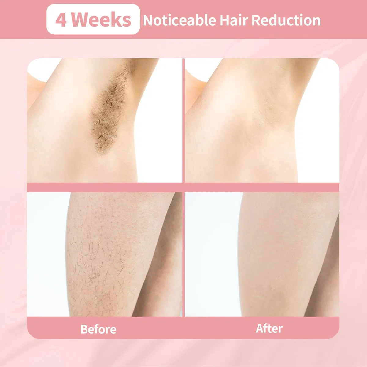 Appareil d'épilation IPL 3 en 1 pour tout le corps, indolore, sûr, pour salons, spas et domicile